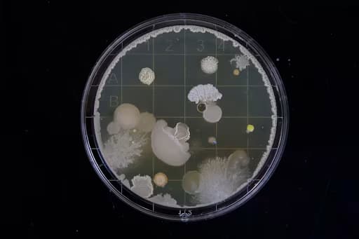 Why Fluorescence Plate Readers Are Essential In Modern Research