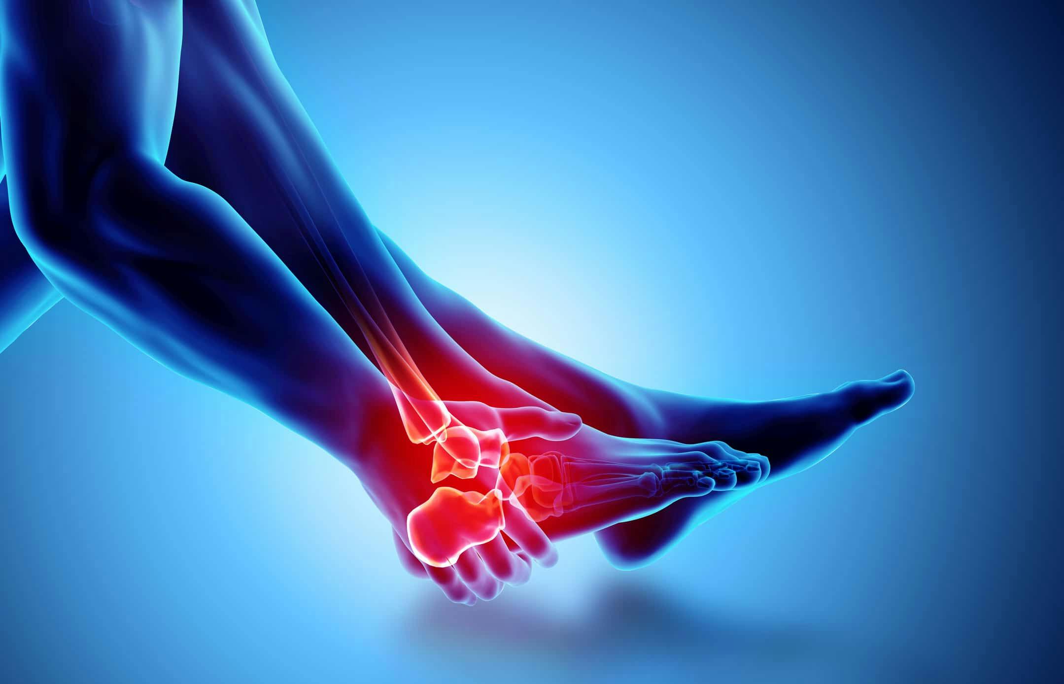 5 Ways Employees Can Prevent Further Nerve Damage After An Ankle Sprain